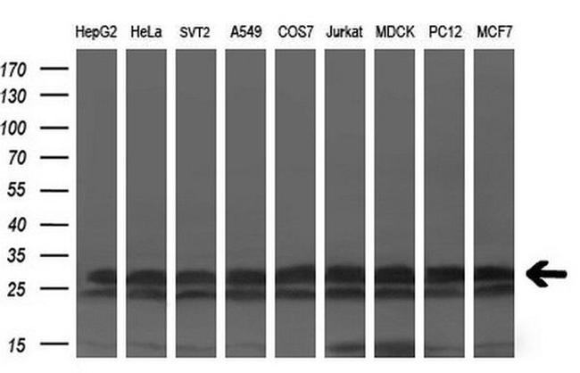 KCTD5 Antibody in Western Blot (WB)