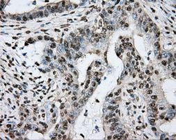 PTPRE Antibody in Immunohistochemistry (Paraffin) (IHC (P))