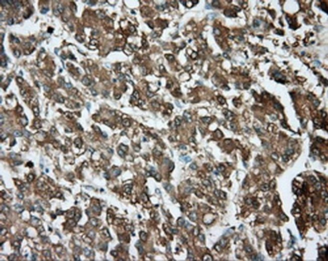 TPMT Antibody in Immunohistochemistry (Paraffin) (IHC (P))