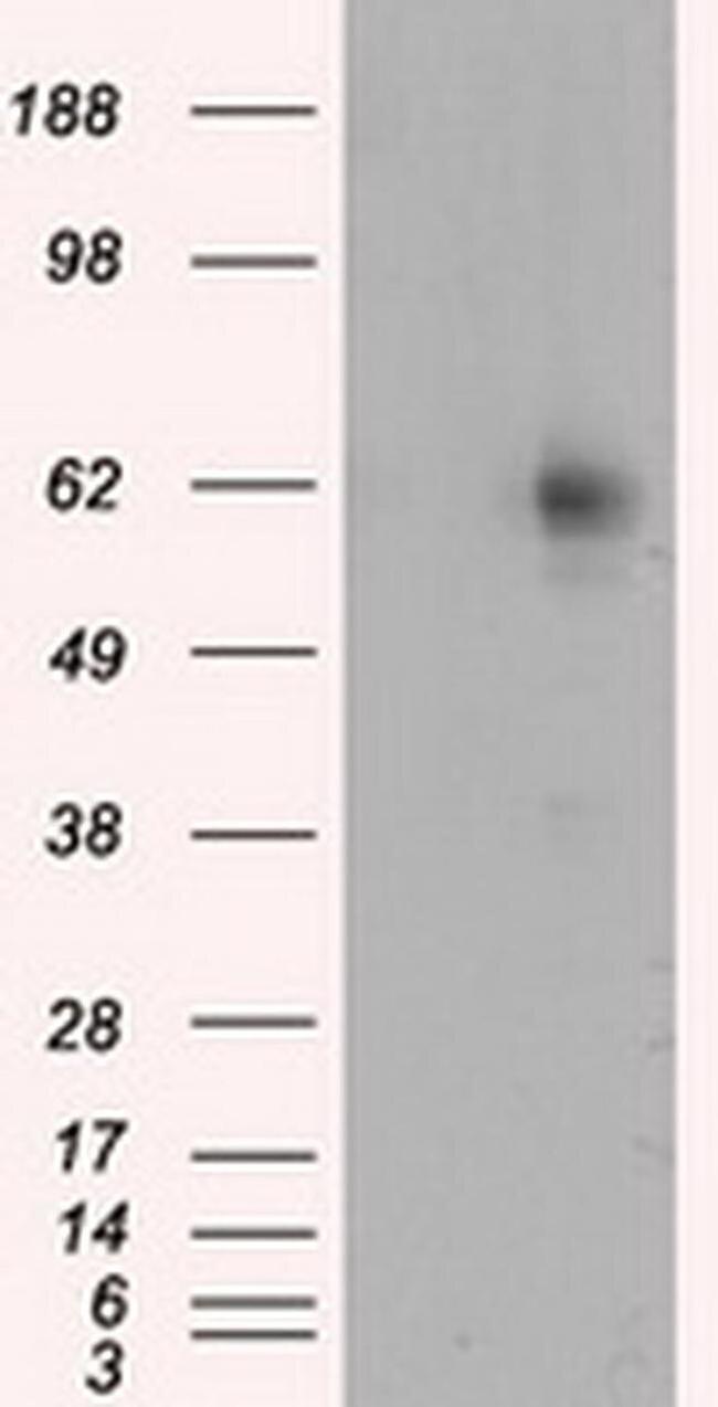 RIC8A Antibody in Western Blot (WB)