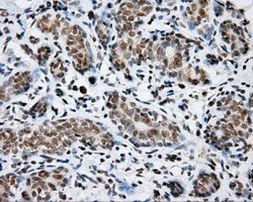 SHC Antibody in Immunohistochemistry (Paraffin) (IHC (P))