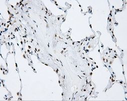 SHC Antibody in Immunohistochemistry (Paraffin) (IHC (P))