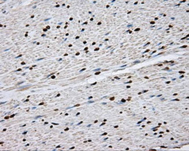 DAPK2 Antibody in Immunohistochemistry (Paraffin) (IHC (P))