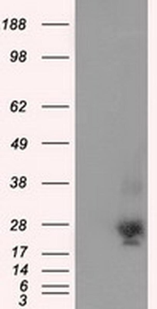 NME4 Antibody in Western Blot (WB)