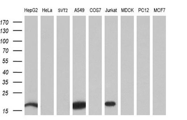 NME4 Antibody in Western Blot (WB)