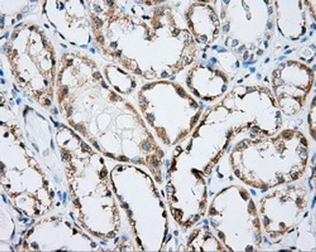 RhoGDI Antibody in Immunohistochemistry (Paraffin) (IHC (P))