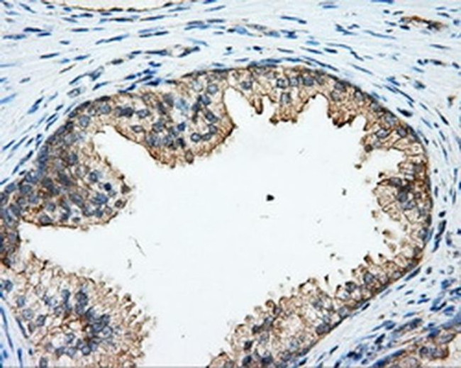 RhoGDI Antibody in Immunohistochemistry (Paraffin) (IHC (P))