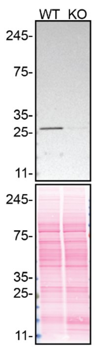 RhoGDI Antibody in Western Blot (WB)