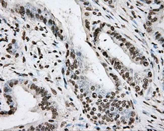 BMAL1 Antibody in Immunohistochemistry (Paraffin) (IHC (P))