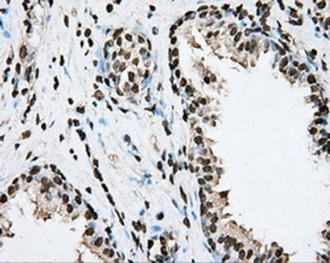 BMAL1 Antibody in Immunohistochemistry (Paraffin) (IHC (P))