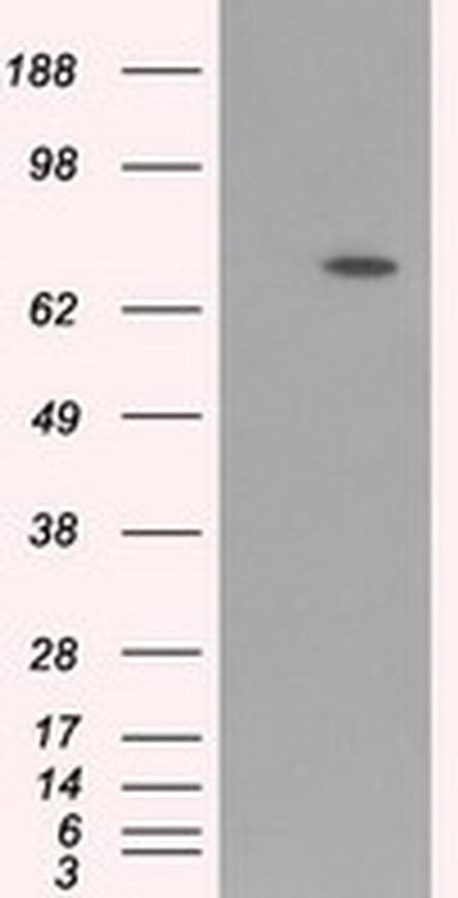 BMAL1 Antibody in Western Blot (WB)