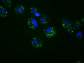 ACSBG1 Antibody in Immunocytochemistry (ICC/IF)