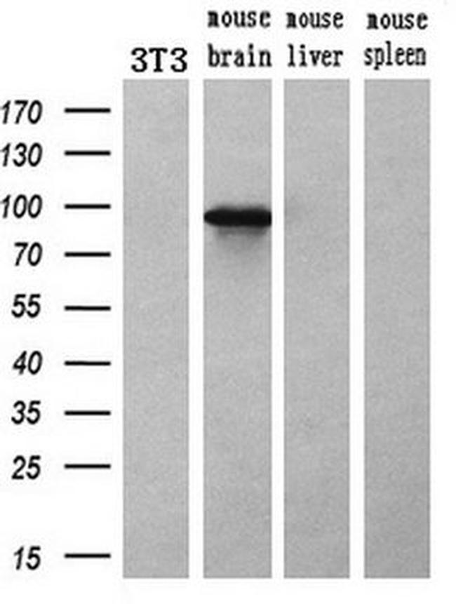 ACSBG1 Antibody in Western Blot (WB)