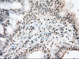 UAP56 Antibody in Immunohistochemistry (Paraffin) (IHC (P))