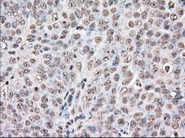 UAP56 Antibody in Immunohistochemistry (Paraffin) (IHC (P))