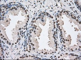 UAP56 Antibody in Immunohistochemistry (Paraffin) (IHC (P))