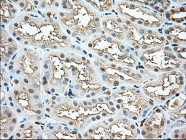 Profilin 1 Antibody in Immunohistochemistry (Paraffin) (IHC (P))