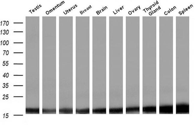 Profilin 1 Antibody in Western Blot (WB)