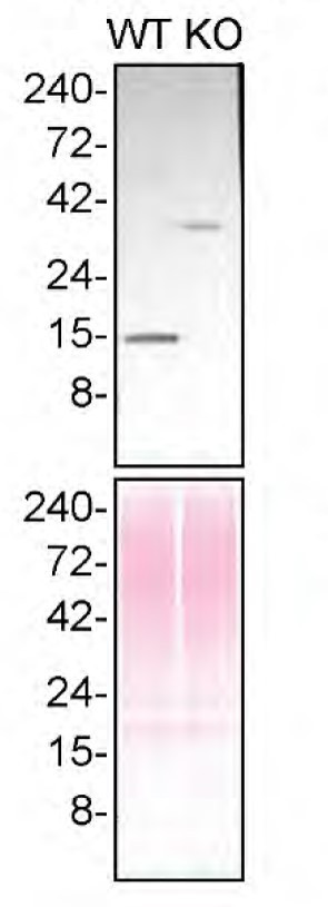 Profilin 1 Antibody