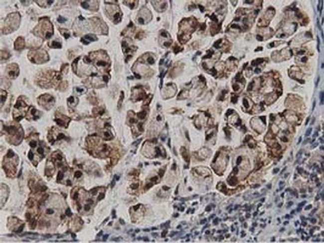 ACAT2 Antibody in Immunohistochemistry (Paraffin) (IHC (P))