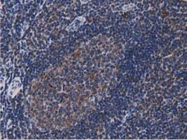 ACAT2 Antibody in Immunohistochemistry (Paraffin) (IHC (P))