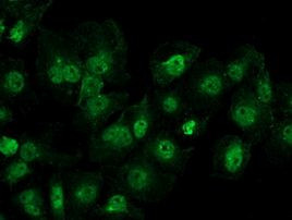 UAP56 Antibody in Immunocytochemistry (ICC/IF)