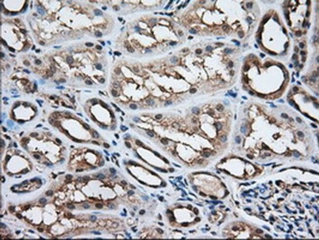 ACAT2 Antibody in Immunohistochemistry (Paraffin) (IHC (P))