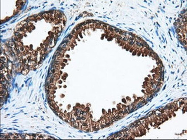 ACAT2 Antibody in Immunohistochemistry (Paraffin) (IHC (P))