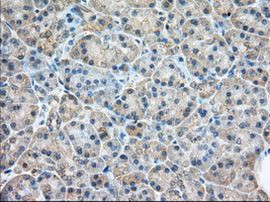 RAB17 Antibody in Immunohistochemistry (Paraffin) (IHC (P))