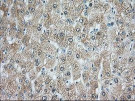 RAB17 Antibody in Immunohistochemistry (Paraffin) (IHC (P))