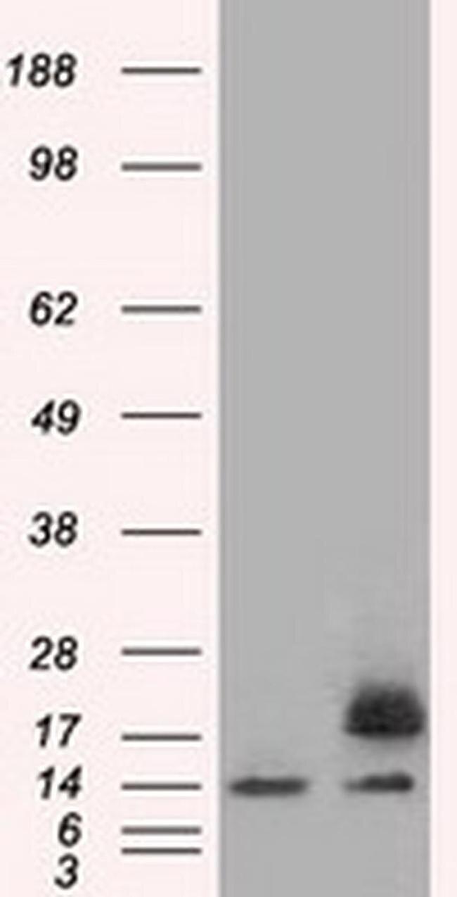 Profilin 1 Antibody in Western Blot (WB)