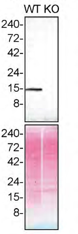 Profilin 1 Antibody in Western Blot (WB)