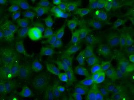 SNX9 Antibody in Immunocytochemistry (ICC/IF)