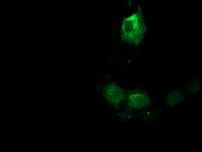 TACC3 Antibody in Immunocytochemistry (ICC/IF)