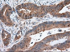 TACC3 Antibody in Immunohistochemistry (Paraffin) (IHC (P))