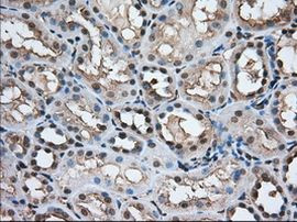 TACC3 Antibody in Immunohistochemistry (Paraffin) (IHC (P))