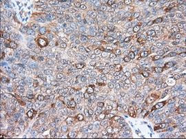 TACC3 Antibody in Immunohistochemistry (Paraffin) (IHC (P))