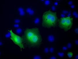 RAB17 Antibody in Immunocytochemistry (ICC/IF)