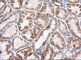 RAB17 Antibody in Immunohistochemistry (Paraffin) (IHC (P))