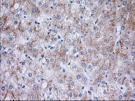 RAB17 Antibody in Immunohistochemistry (Paraffin) (IHC (P))