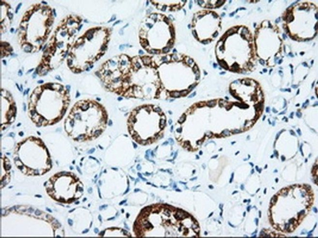 IGF2BP2 Antibody in Immunohistochemistry (Paraffin) (IHC (P))