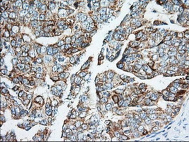 IGF2BP2 Antibody in Immunohistochemistry (Paraffin) (IHC (P))