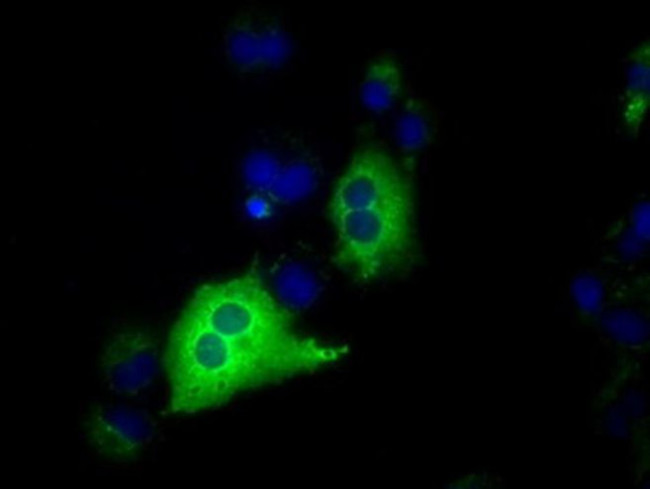 IGF2BP2 Antibody in Immunocytochemistry (ICC/IF)