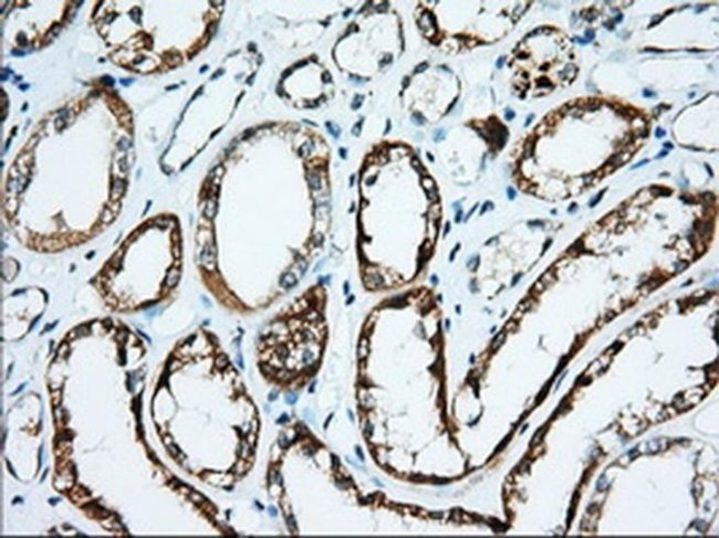 IGF2BP2 Antibody in Immunohistochemistry (Paraffin) (IHC (P))