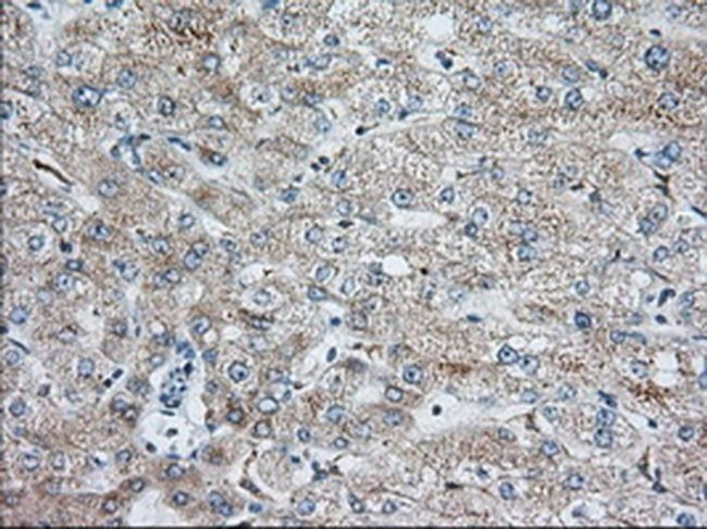 IGF2BP2 Antibody in Immunohistochemistry (Paraffin) (IHC (P))