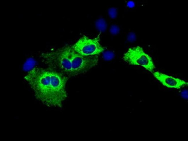 IGF2BP2 Antibody in Immunocytochemistry (ICC/IF)