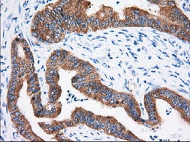 IGF2BP2 Antibody in Immunohistochemistry (Paraffin) (IHC (P))