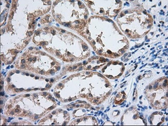 IGF2BP2 Antibody in Immunohistochemistry (Paraffin) (IHC (P))