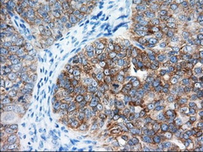 IGF2BP2 Antibody in Immunohistochemistry (Paraffin) (IHC (P))