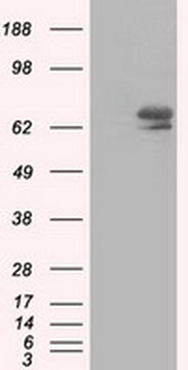 IGF2BP2 Antibody in Western Blot (WB)